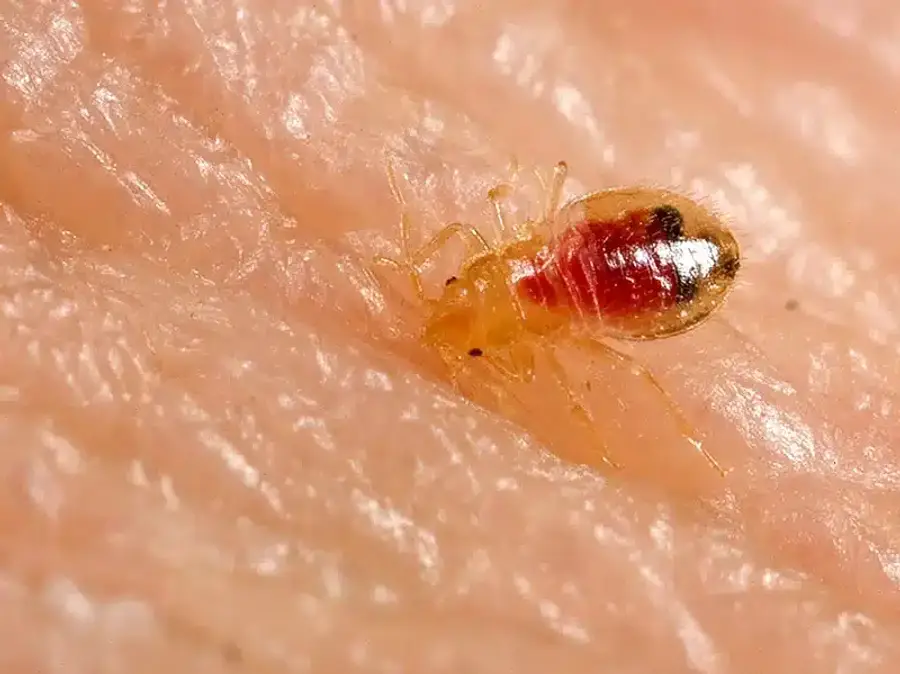 Close-up of a bed bug on human skin
