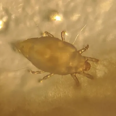 Magnified view of a cheese mite showing its pale translucent body and eight legs