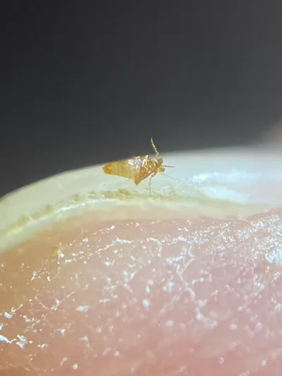 Tiny chigoe flea on human skin showing its small yellowish-tan body