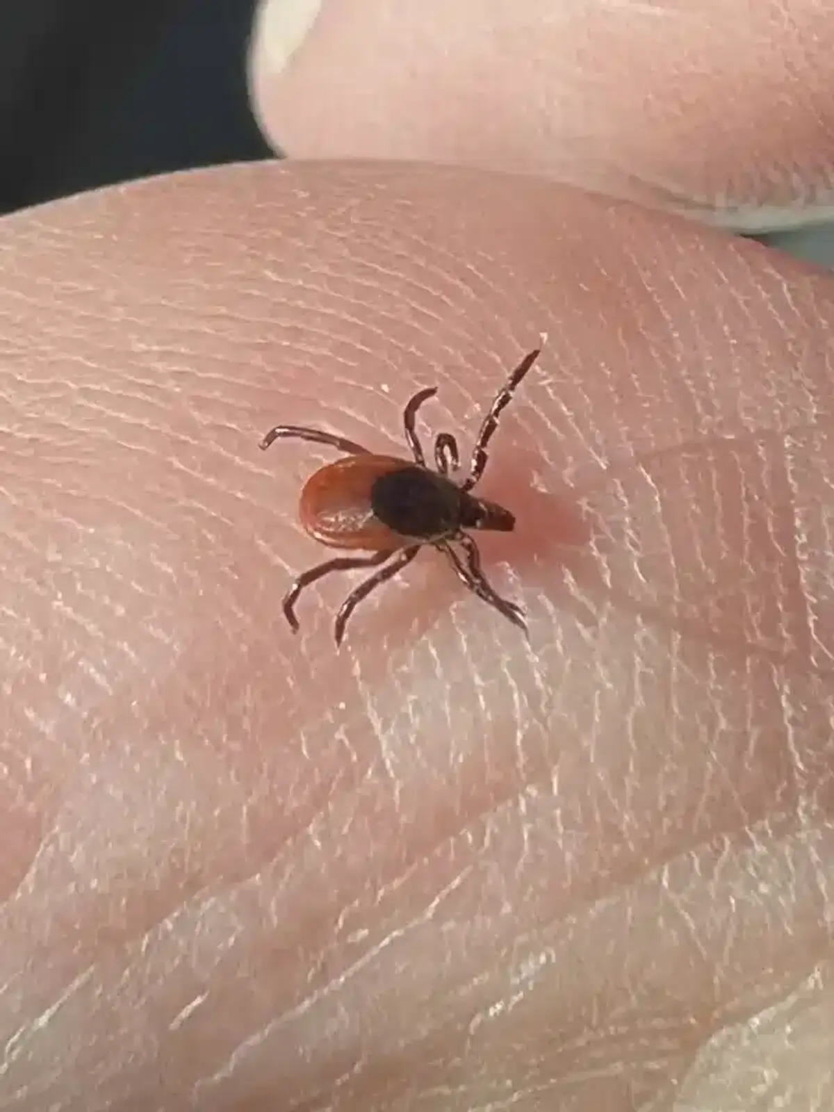 Deer tick on human skin showing the small size and appearance of Maryland's most common Lyme disease vector