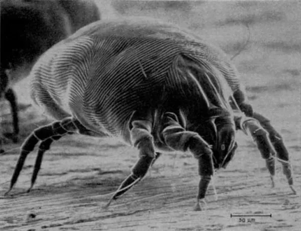 Scanning electron microscope image of a house dust mite showing its eight legs and rounded body