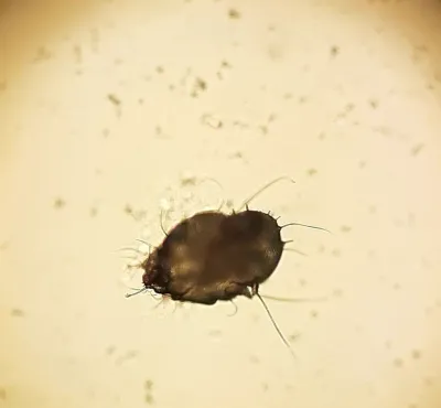 Microscopic view of a fur mite showing its oval body and eight legs with distinctive hooked mouthparts