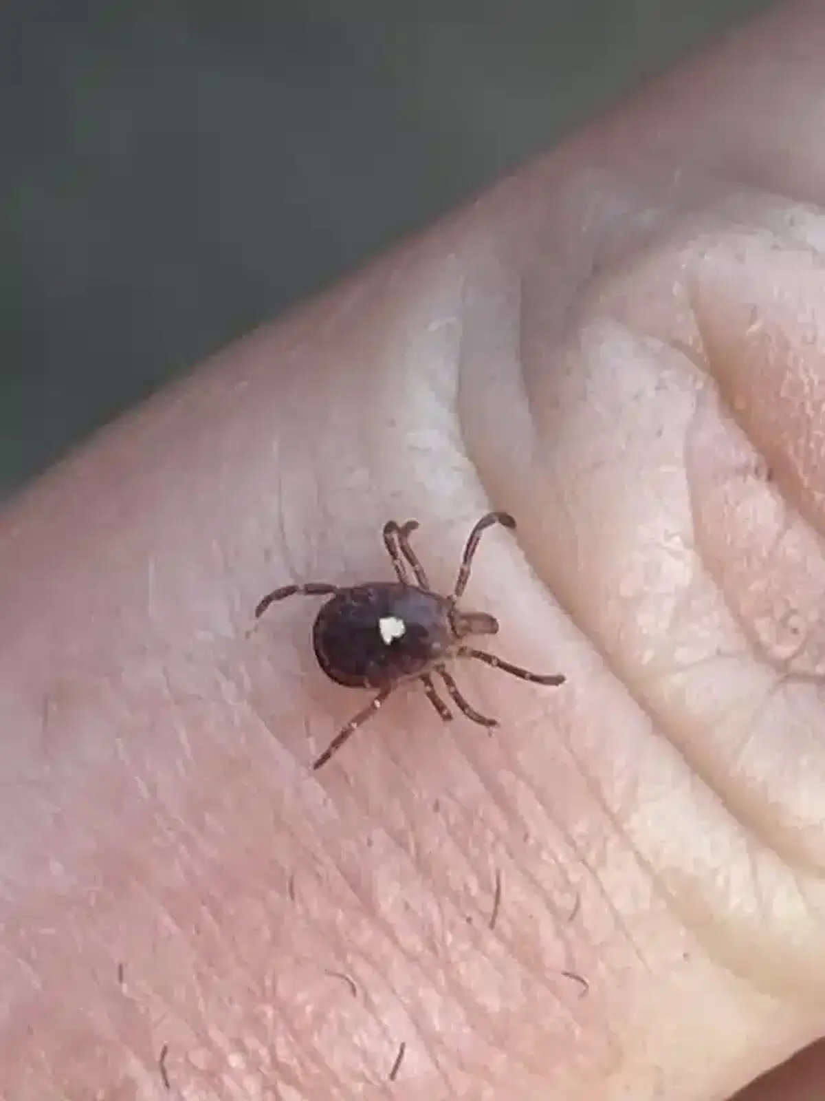 Adult female lone star tick with a white dot on its back crawling on a person's hand