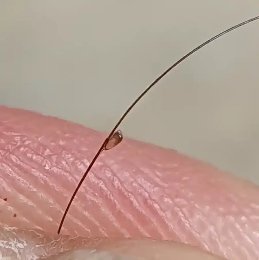 Louse egg attached to human hair