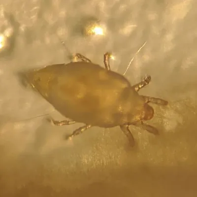 Magnified view of a pantry mite showing its oval translucent body and eight legs