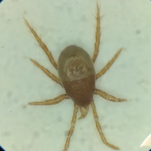 Microscope view of a predatory mite showing its pear-shaped body and eight legs in top-down view