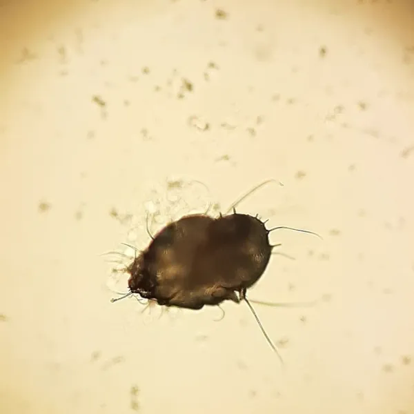Microscopic view of a scabies mite showing its oval body and eight legs