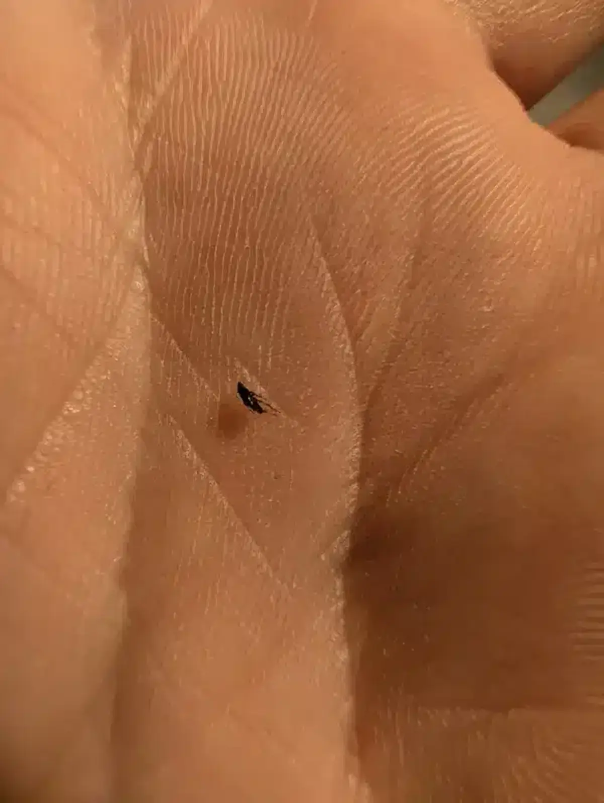 Small flea on human palm