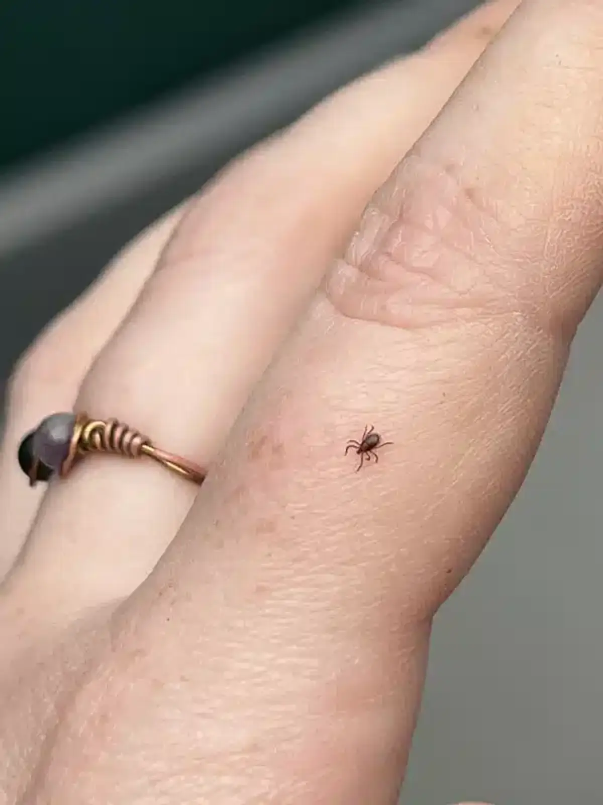 Small tick on human hand showing relative size