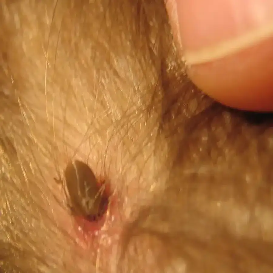 Tick embedded in skin
