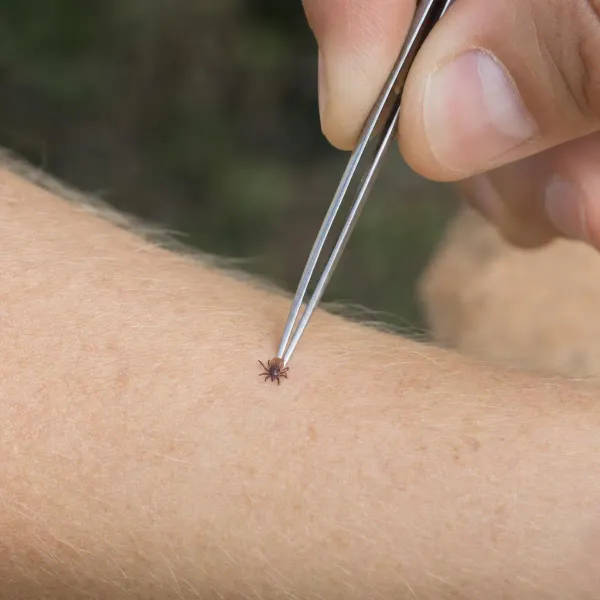 Tick Removal: How to Remove a Tick the Right Way, Step by Step