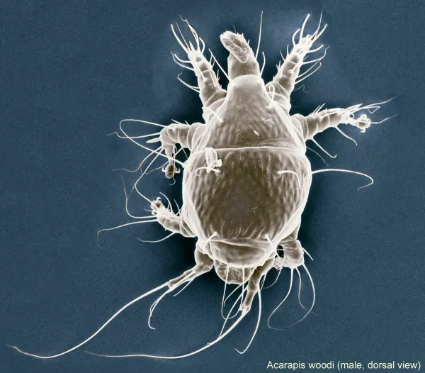 Scanning electron microscope image of a male tracheal mite showing dorsal view with eight legs and oval body