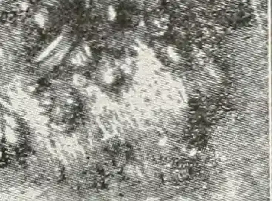 Blurry image related to pests or landmarks.