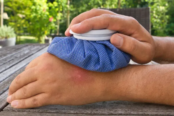 Yellow Jacket Sting Won't Stop Hurting? What It Means